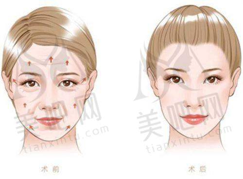 擅长项目介绍