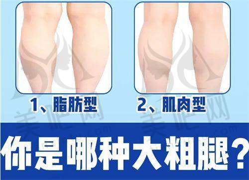 是否值得去