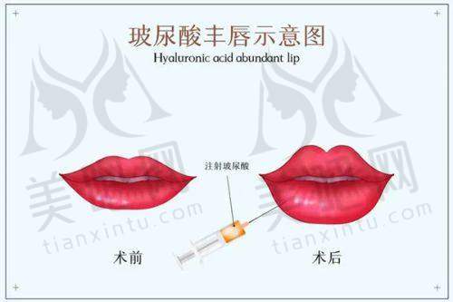 与温州其他整形医院对比