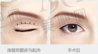 洛阳谢景良医疗美容靠谱吗？有先进设备，抽脂技术强，还提供全面医美服务
