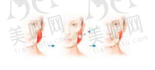 温州尚星医疗美容门诊部值得去吗？