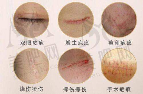 成都渼淳玉颜医疗美容门诊部靠谱吗？刘玉辉医生唇部整形好，多项目价格可参考