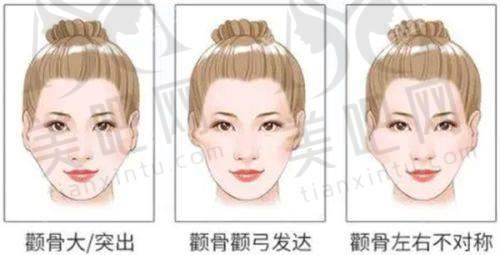 哈尔滨索菲医疗美容门诊部靠不靠谱？医生技术、资质口碑、服务活动全分析