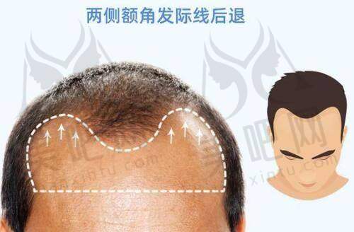 塑美项目特色