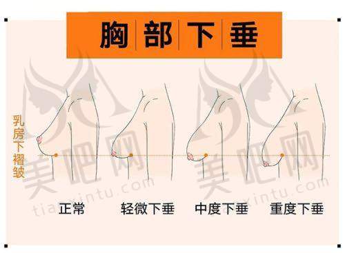 广美美雅2025年价格表