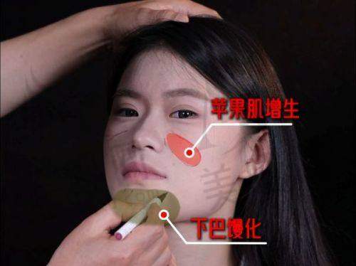 沈阳颜悦医疗美容诊所靠谱吗？医生经验足案例好，祛斑丰胸治腋臭优势多