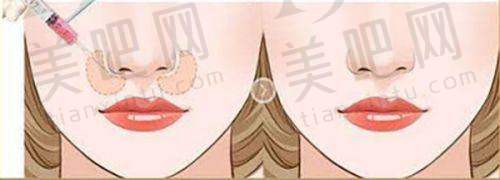 术后护理指导