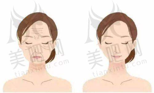 口碑与发展