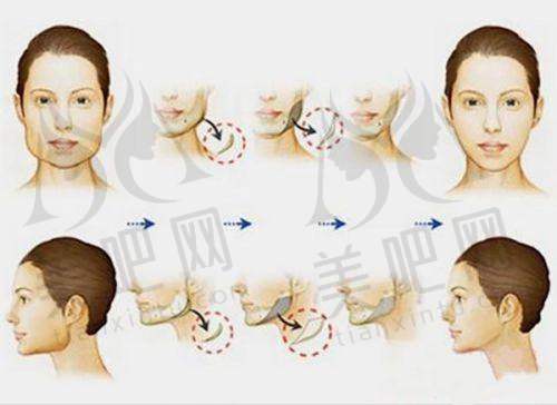 绿园区莎图蕊医疗美容门诊部靠谱吗？有先进设备，下颌角整形等项目效果有案例见证