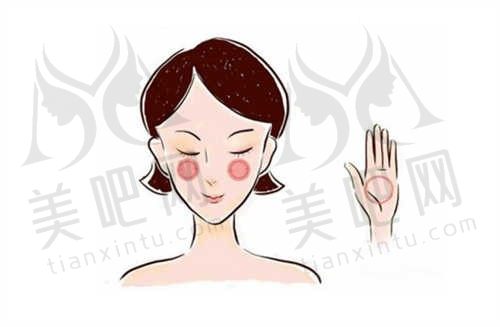 假体下巴
