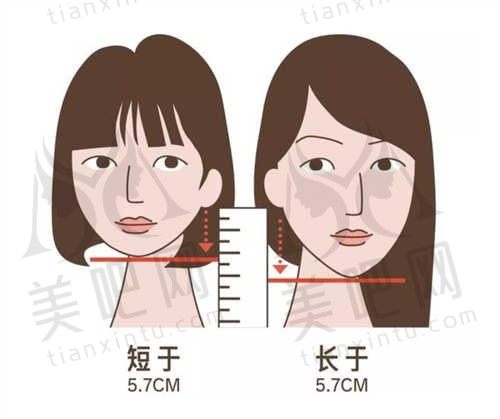 减双下巴失败修复