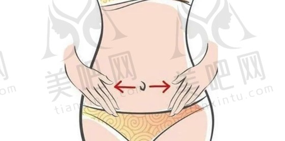 光纤溶脂瘦臀部