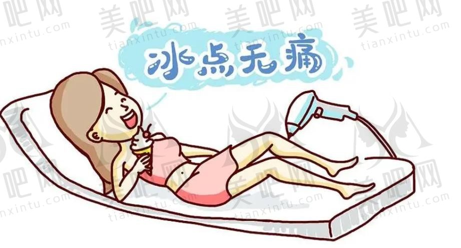 冰点脱毛