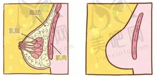 抽脂缩小巨乳