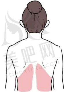 射频溶脂瘦后背