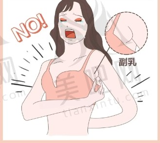 去副乳失败修复