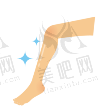射频溶脂瘦小腿
